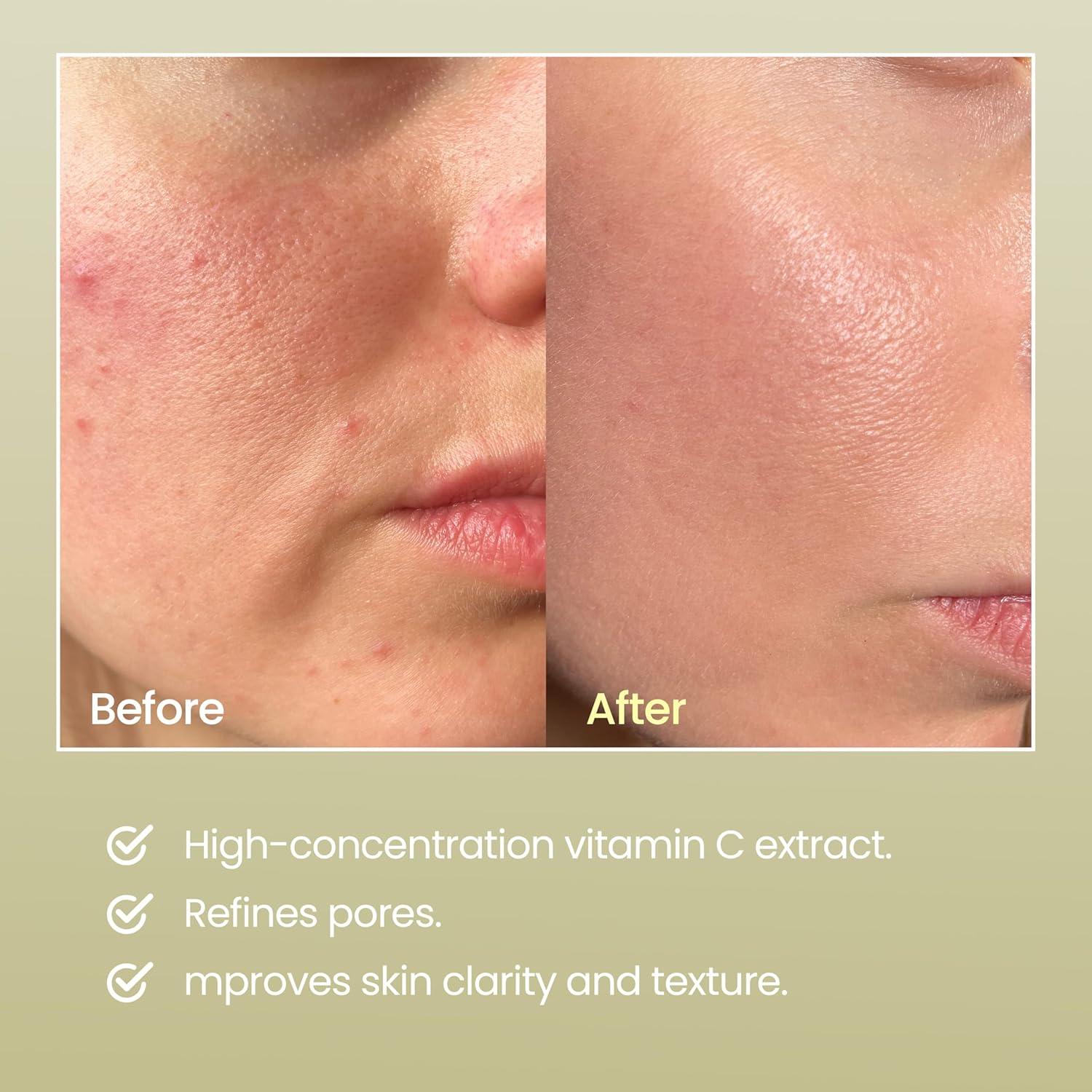 imageDERMALOGY by NEOGEN Real Vitamin C Serum 112 oz 32g Brightening Revitalizing Serum with 22 Pure Ascorbic Acid Ferulic Acid Zinc and Niacinamide Korean Skin Care
