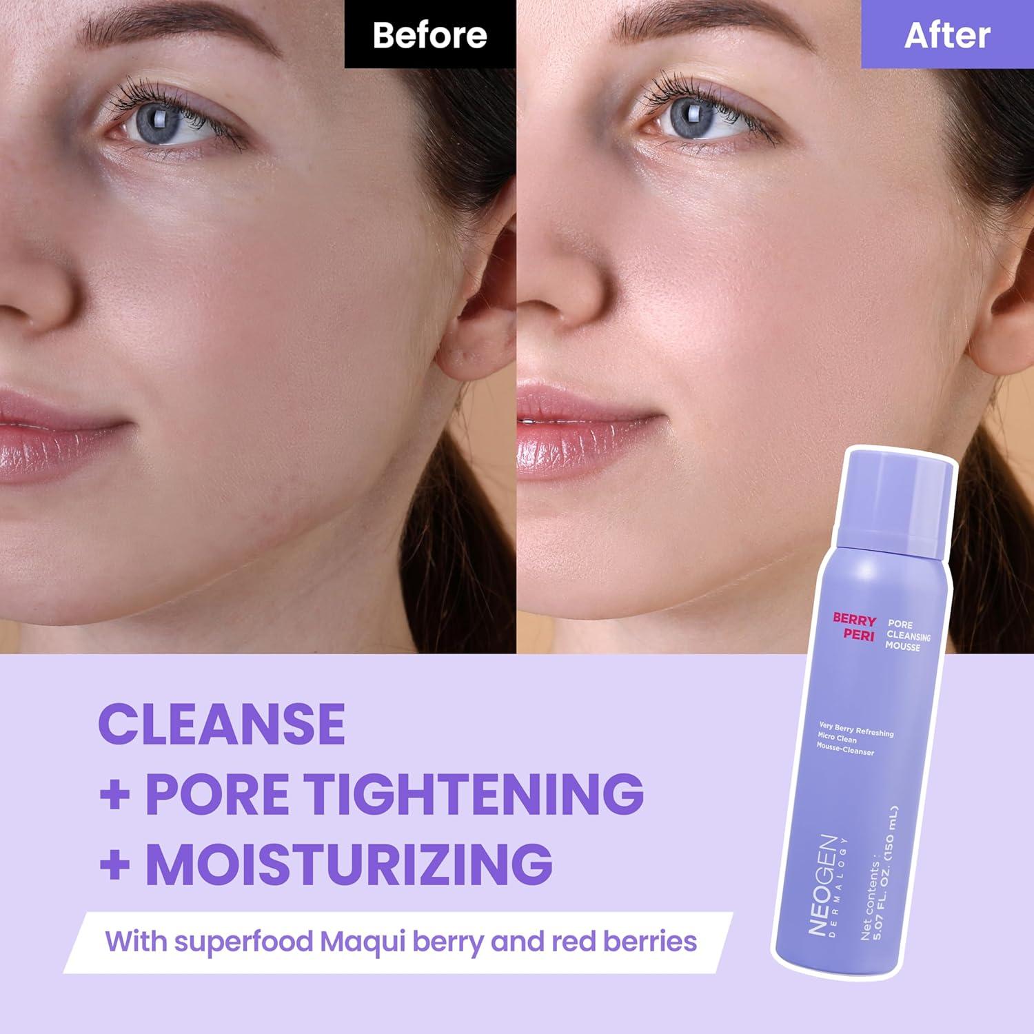 imageDERMALOGY by NEOGENLAB BerryPore Pore Cleansing Mousse Deep Pore Cleanser with AHABHA Removes Excess Oil amp Impurities KBeauty Face Wash 507 fl oz 150 ml