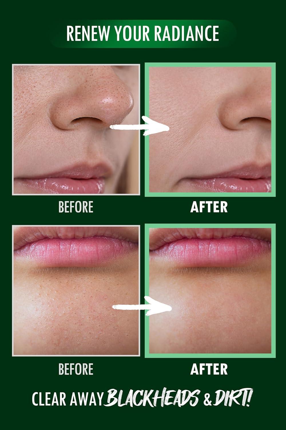 imageKBeauty Neogen Dermalogy Pore Zero Peeling Mousse AllinOne Foaming Exfoliating Face Wash Visibly Firming Tightening amp Lifting Skin 338 fl ozPore Zero