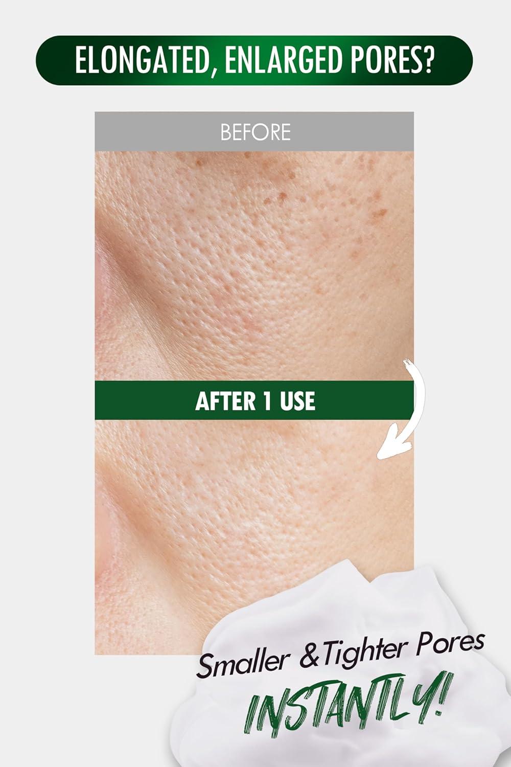 imageKBeauty Neogen Dermalogy Pore Zero Peeling Mousse AllinOne Foaming Exfoliating Face Wash Visibly Firming Tightening amp Lifting Skin 338 fl ozPore Zero