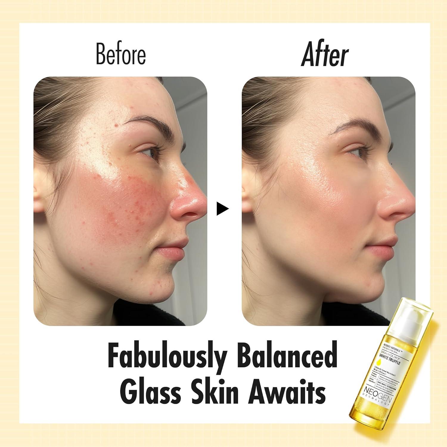 imageKBeauty Neogen Dermalogy White Truffle Serum in Oil Drop w 3 Hyaluronic Acid amp Niacinamide Hydrating Face Oil Korean Glass Skin Serum 169 fl oz